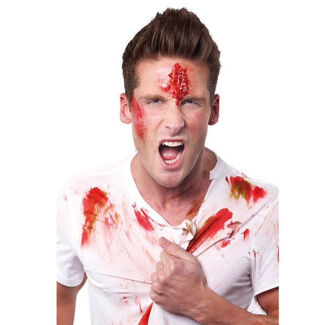 Boland Tube nepbloed