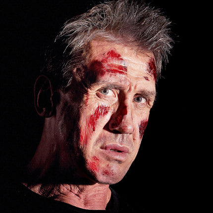 Widmann SRL 6 Brandwond tattoo nep