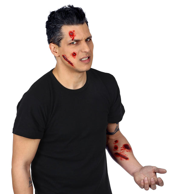 Widmann SRL Nep brand-wonden-set