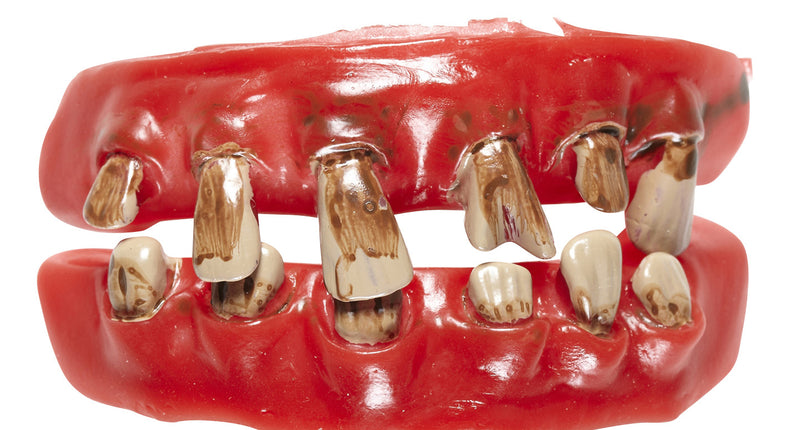 Widmann SRL Nep gebit rotte tanden