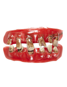 Widmann SRL Nep gebit rotte tanden