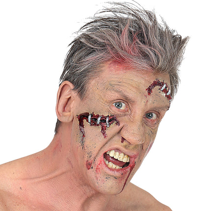 Widmann SRL Open wond klein met nietjes