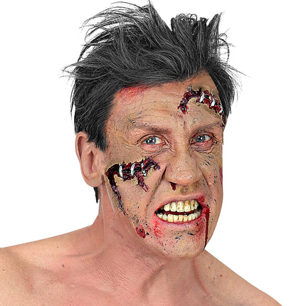 Widmann SRL Open wond klein met nietjes